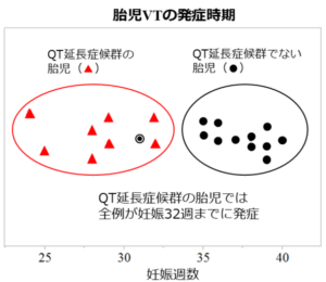 妊娠中の胎児治療の標準化へ前進　超希少疾患「胎児心室頻拍」の実態を解明